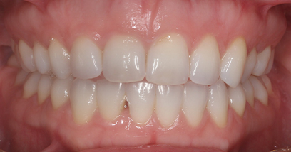 Before & Afters