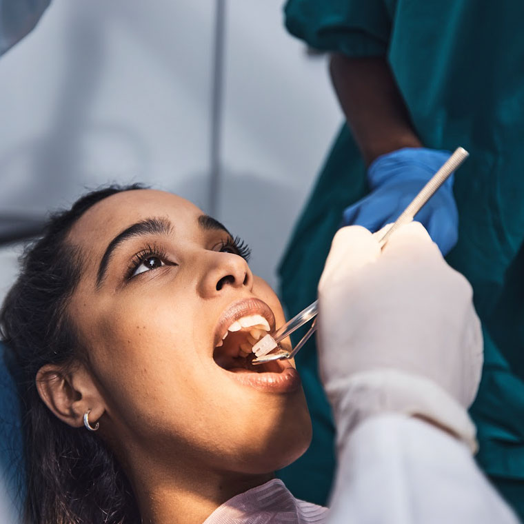 What to expect during MARPE treatment