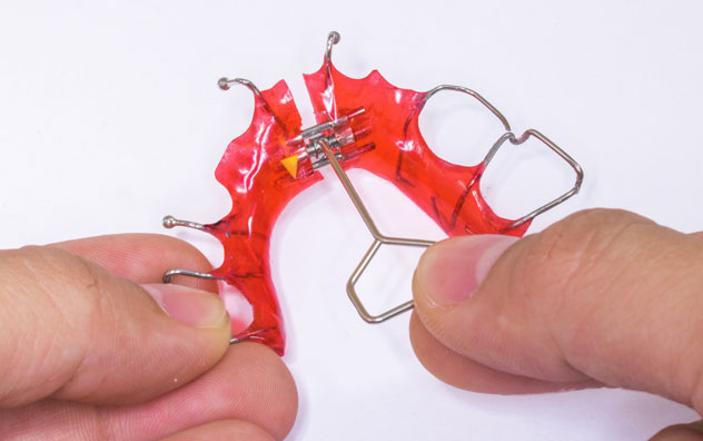 Upper removable appliance