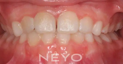 Before & Afters