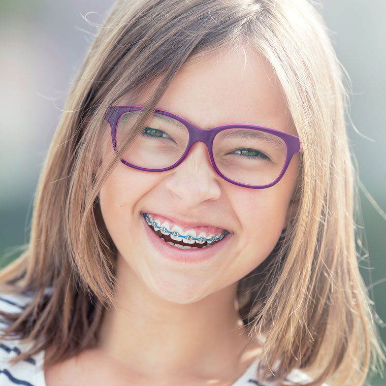 Ceramic-braces.jpg