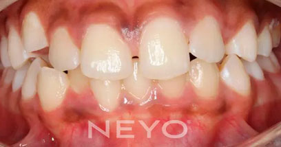 Before & Afters
