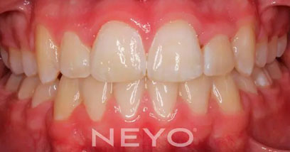 Before & Afters