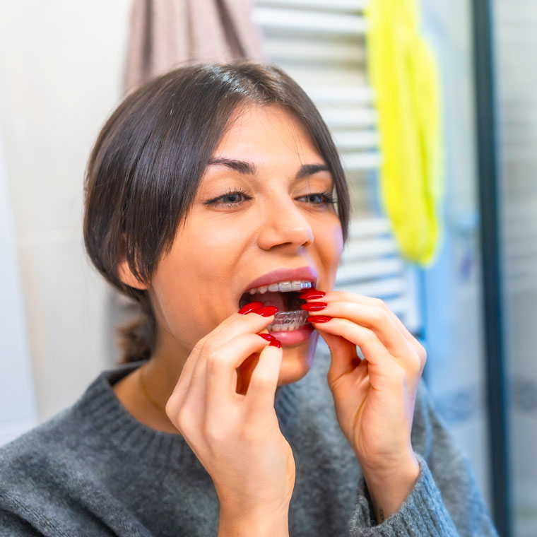 Is Invisalign® the best aligner system?