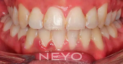 Before & Afters