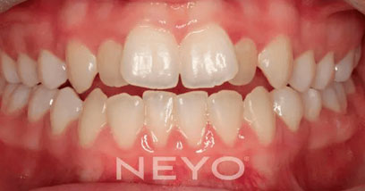 Before & Afters
