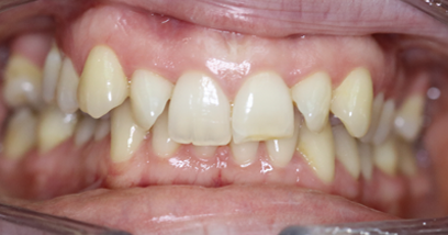 Before & Afters