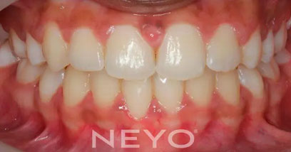 Before & Afters
