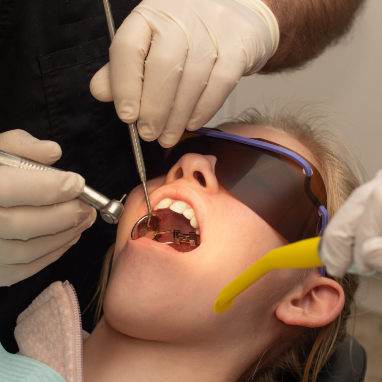 Who we offer MARPE to