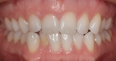 Before & Afters